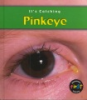 Pink_eye