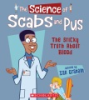 The_science_of_scabs_and_pus
