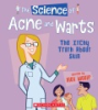 The_science_of_acne_and_warts